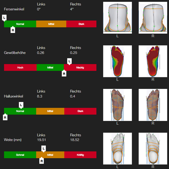Individual foot analysis ONLINE
