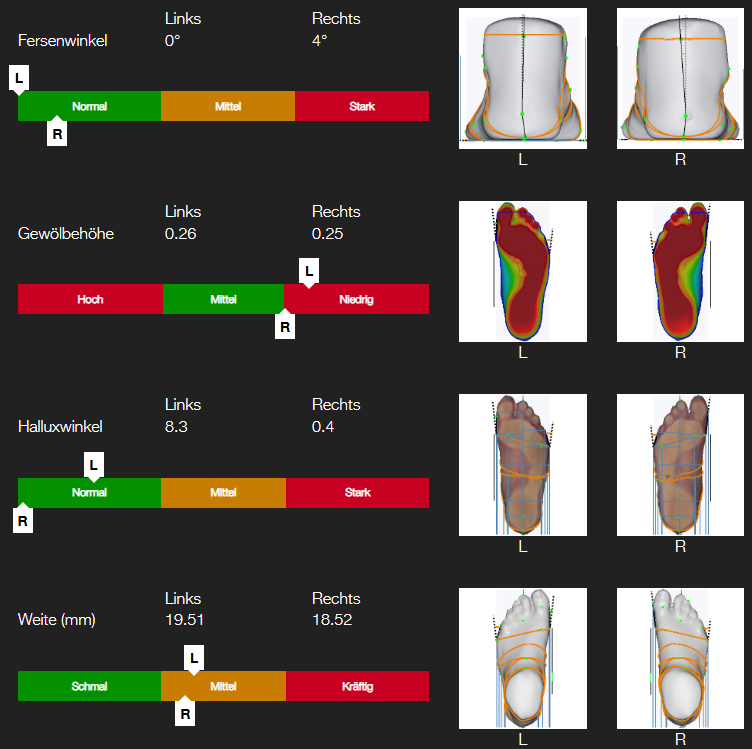 Individual foot analysis ONLINE